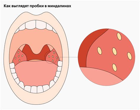 Вред притертой пробки в бюксе