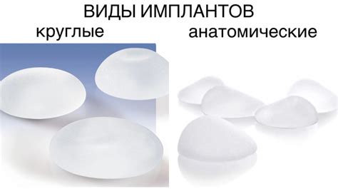 Импланты для увеличения объема рюкзака