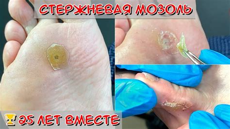 Как избавиться от пемзы дома