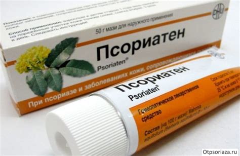 Натуральные средства для лечения и профилактики шпоры на мизинце