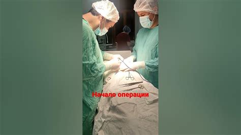 Начало удаления МСН