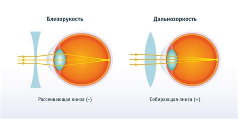 Определение выгорания линзы на глаз