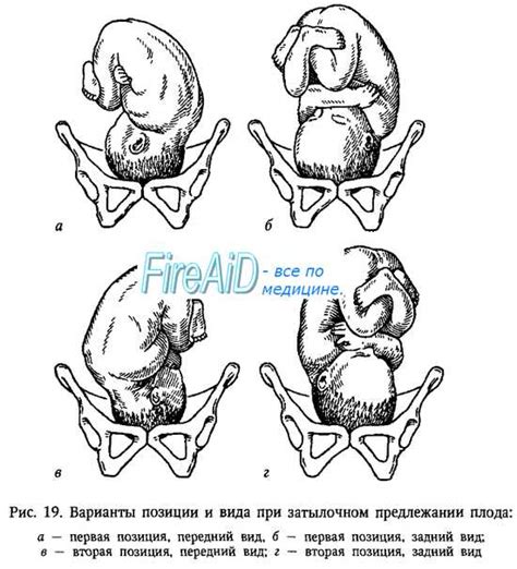 Определите наилучшую позицию сиденья