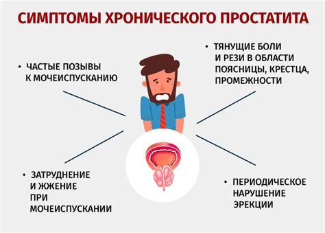 Основные принципы массажа простаты