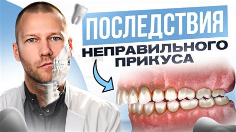 Последствия неправильного указания возраста