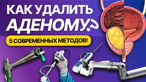 Преимущества массажа простаты