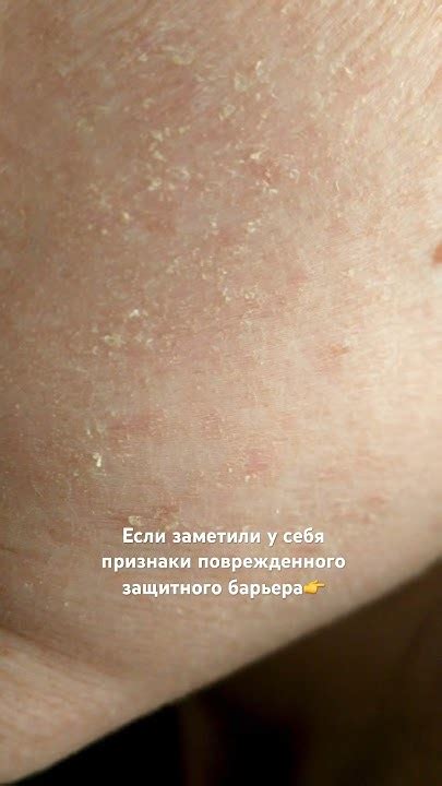 Признаки поврежденного пина