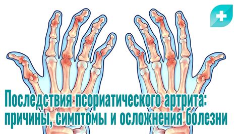 Регулярно проводите самомассаж