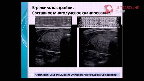 Режимы работы и настройки сканера лица