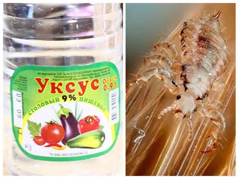 Рецепт уксуса от вшей
