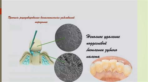 Снюс и здоровье полости рта