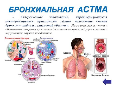 Что такое астма